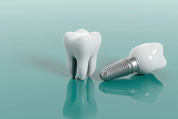 Dental Implantology
